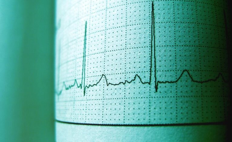 voicemail frequency time analysis